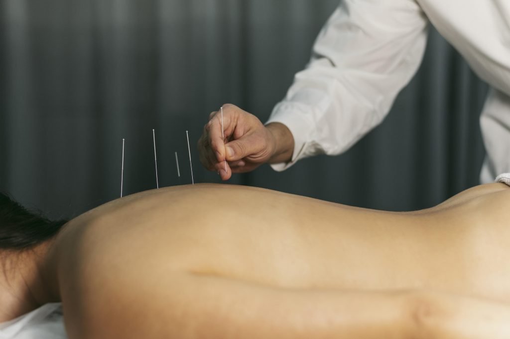 Acupuncturist in Oss
